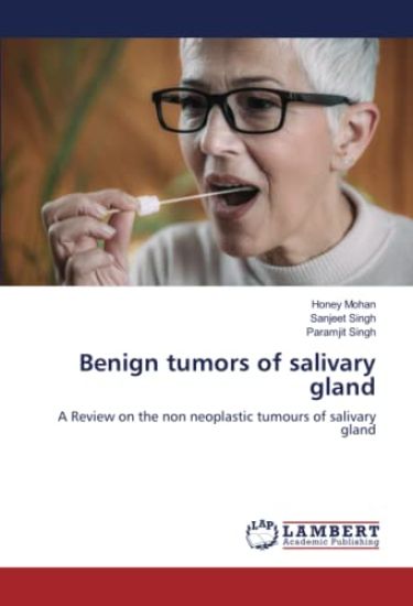Benign tumors of salivary gland