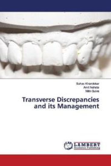 Transverse Discrepancies and its Management