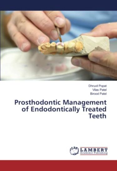Prosthodontic Management of Endodontically Treated Teeth