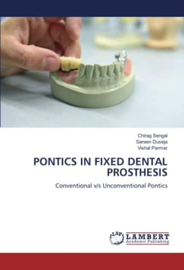 PONTICS IN FIXED DENTAL PROSTHESIS