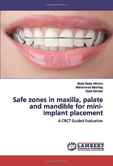 Safe zones in maxilla, palate and mandible for mini-implant placement