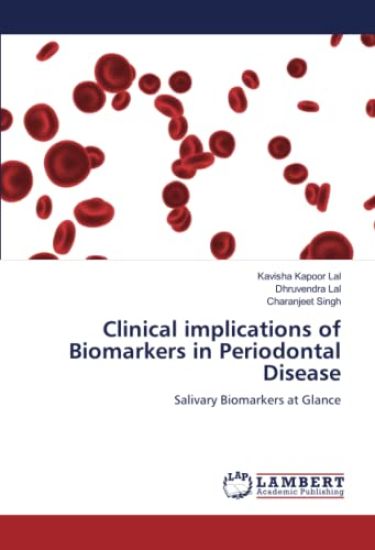 Clinical implications of Biomarkers in Periodontal Disease