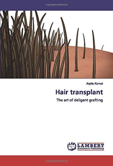 Hair transplant