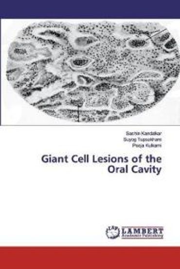 Giant Cell Lesions of the Oral Cavity