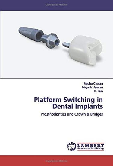 Platform Switching in Dental Implants