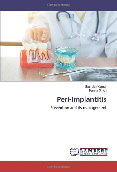 Peri-Implantitis