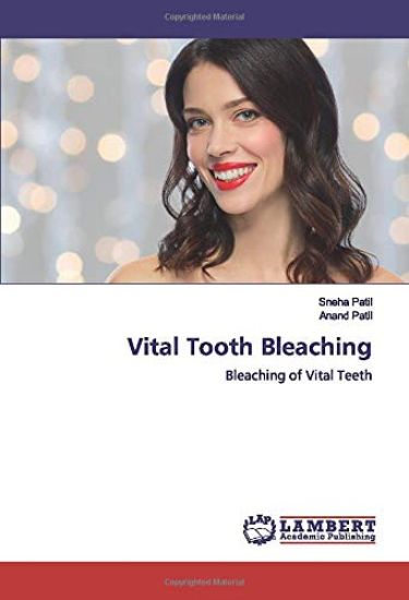 Vital Tooth Bleaching