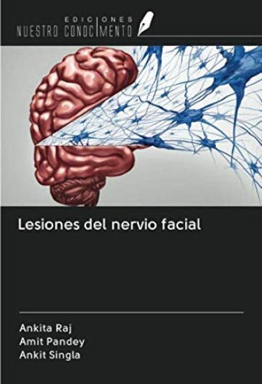 Lesiones del nervio facial
