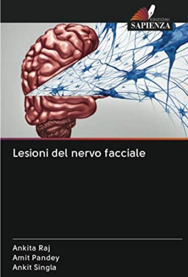 Lesioni del nervo facciale