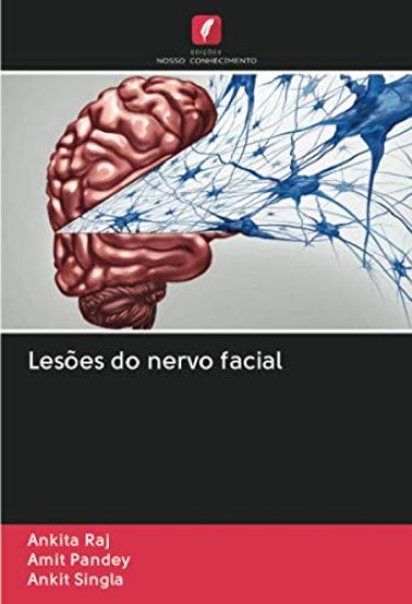 Lesões do nervo facial