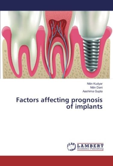 Factors affecting prognosis of implants