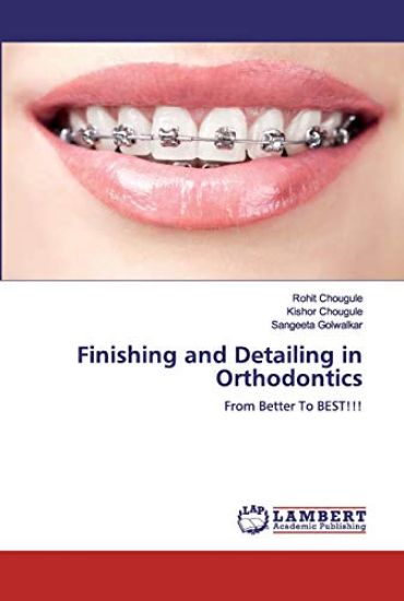 Finishing and Detailing in Orthodontics