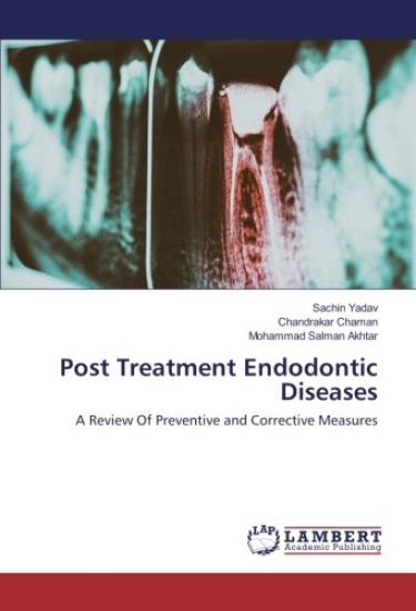 Post Treatment Endodontic Diseases – Sachin Yadav, kirjan kansikuva