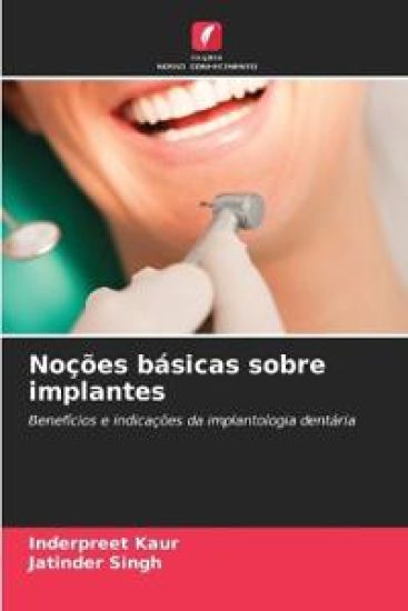 Noções básicas sobre implantes