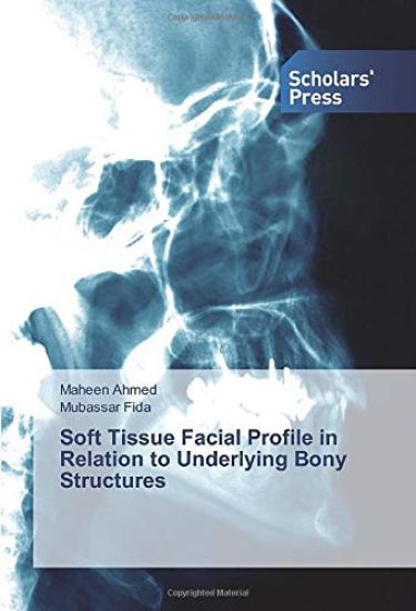 Soft Tissue Facial Profile in Relation to Underlying Bony Structures