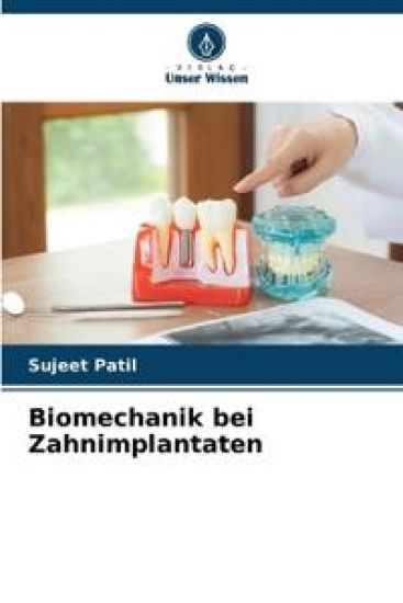 Biomechanik bei Zahnimplantaten