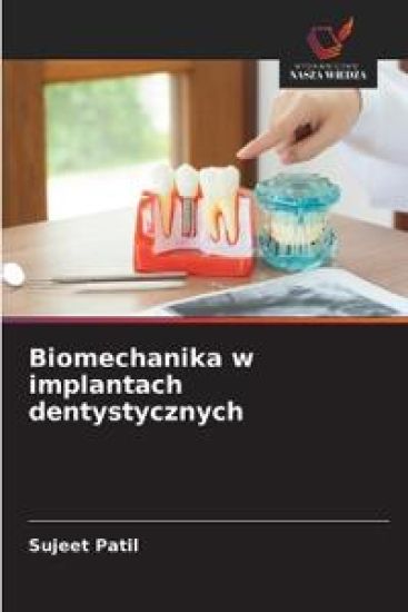 Biomechanika w implantach dentystycznych