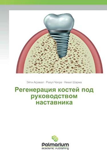 Regeneraciq kostej pod rukowodstwom nastawnika