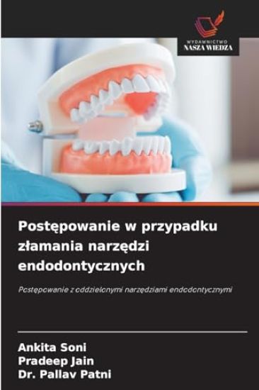 Postepowanie w przypadku zlamania narzedzi endodontycznych