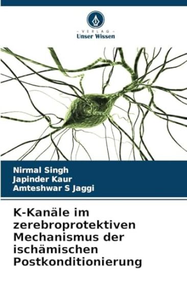 K-Kanäle im zerebroprotektiven Mechanismus der ischämischen Postkonditionierung