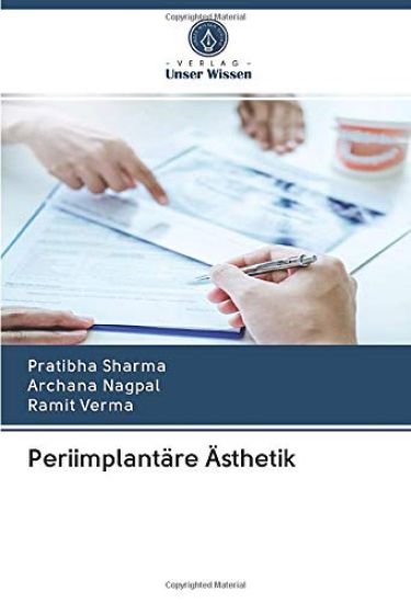 Periimplantäre Ästhetik