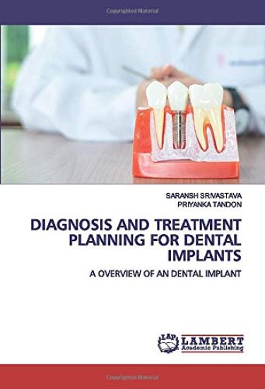 DIAGNOSIS AND TREATMENT PLANNING FOR DENTAL IMPLANTS