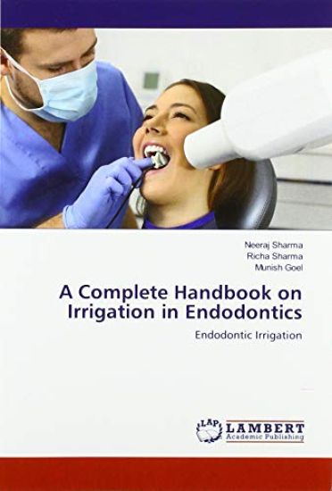 A Complete Handbook on Irrigation in Endodontics