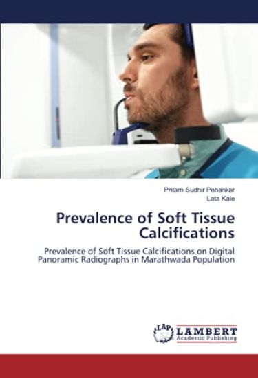 Prevalence of Soft Tissue Calcifications