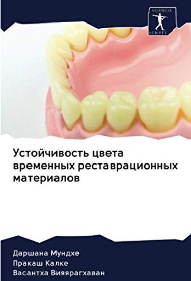 Ustojchiwost' cweta wremennyh restawracionnyh materialow