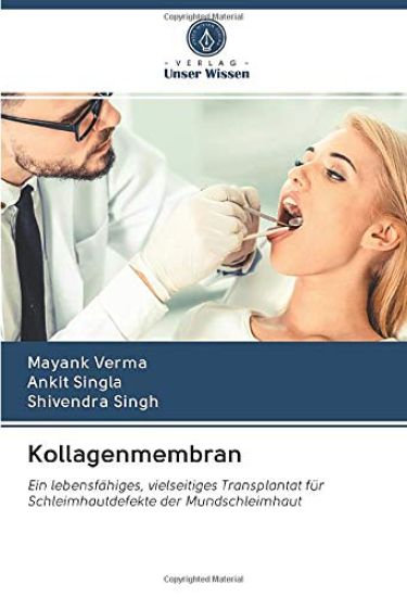 Kollagenmembran