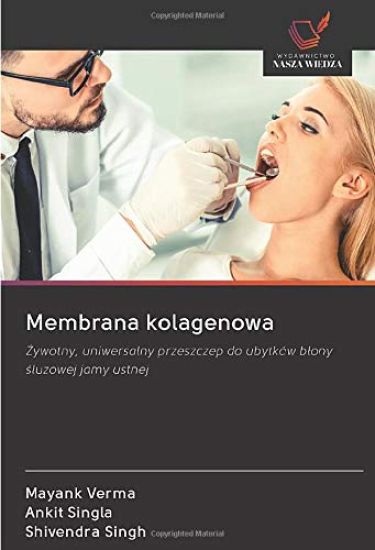 Membrana kolagenowa