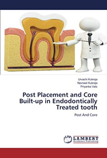 Post Placement and Core Built-up in Endodontically Treated tooth