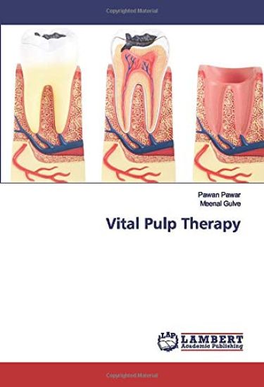 Vital Pulp Therapy