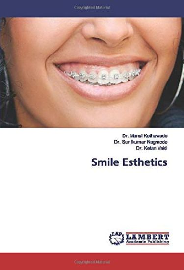 Smile Esthetics