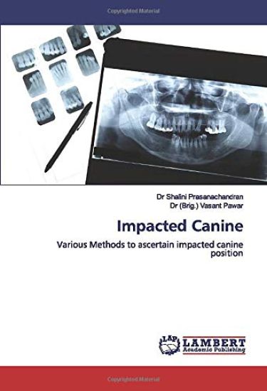 Impacted Canine