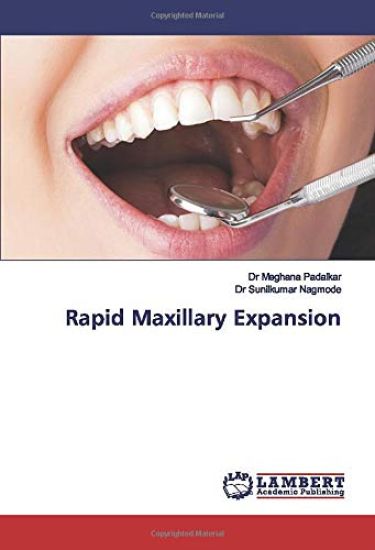 Rapid Maxillary Expansion
