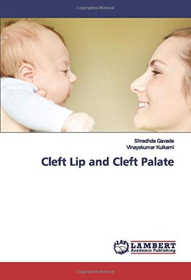 Cleft Lip and Cleft Palate