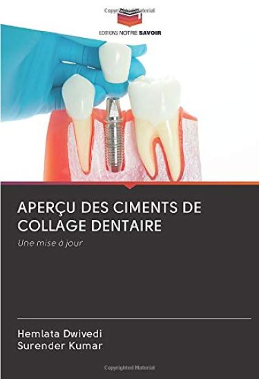 APERÇU DES CIMENTS DE COLLAGE DENTAIRE