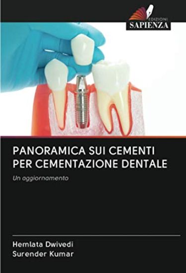 PANORAMICA SUI CEMENTI PER CEMENTAZIONE DENTALE
