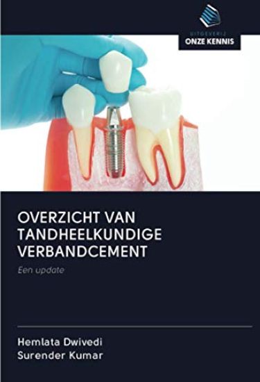 OVERZICHT VAN TANDHEELKUNDIGE VERBANDCEMENT