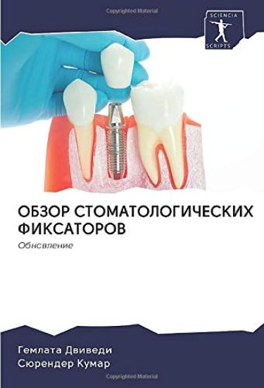 OBZOR STOMATOLOGIChESKIH FIKSATOROV