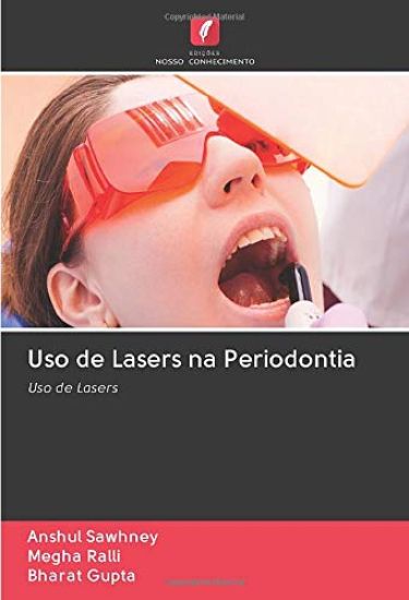 Uso de Lasers na Periodontia