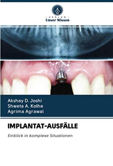 IMPLANTAT-AUSFÄLLE
