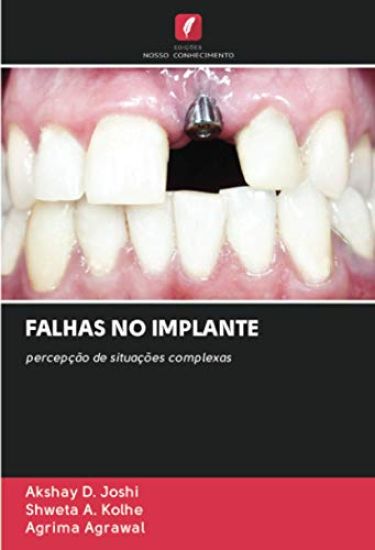 FALHAS NO IMPLANTE