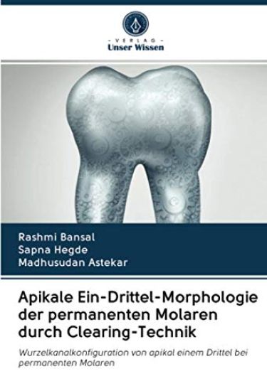 Apikale Ein-Drittel-Morphologie der permanenten Molaren durch Clearing-Technik