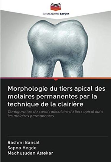 Morphologie du tiers apical des molaires permanentes par la technique de la clairière
