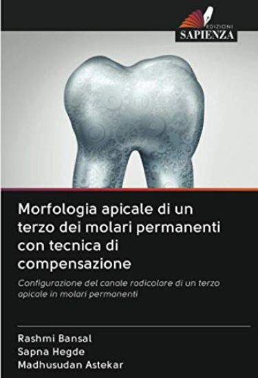 Morfologia apicale di un terzo dei molari permanenti con tecnica di compensazione