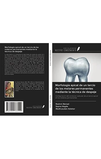 Morfología apical de un tercio de los molares permanentes mediante la técnica de despeje