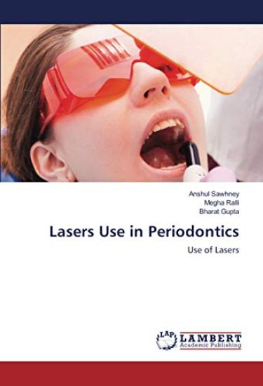 Lasers Use in Periodontics