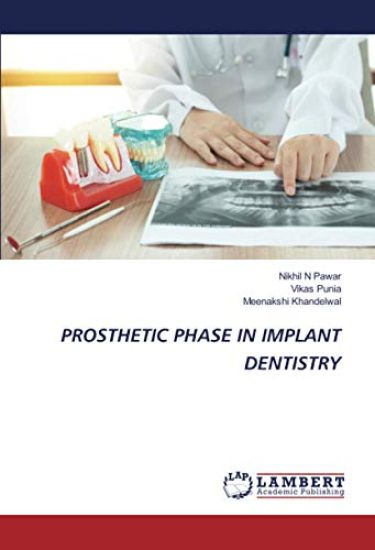 PROSTHETIC PHASE IN IMPLANT DENTISTRY